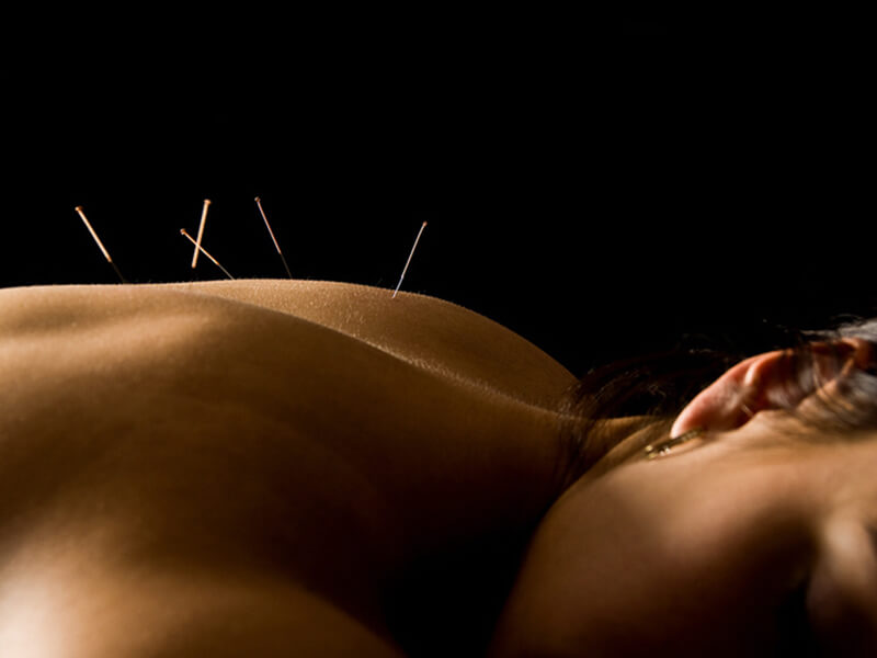 Manualna terapija in masaže Bruno Modno frizerstvo Frizerski salon Yvonne Dry Needling 5 800x600
